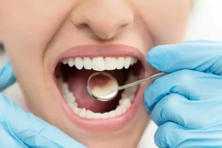 Causes of bad cavities by bad practices?
