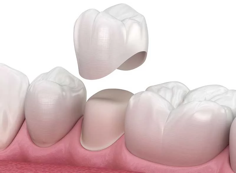 How To Get Rid of Cavity?
