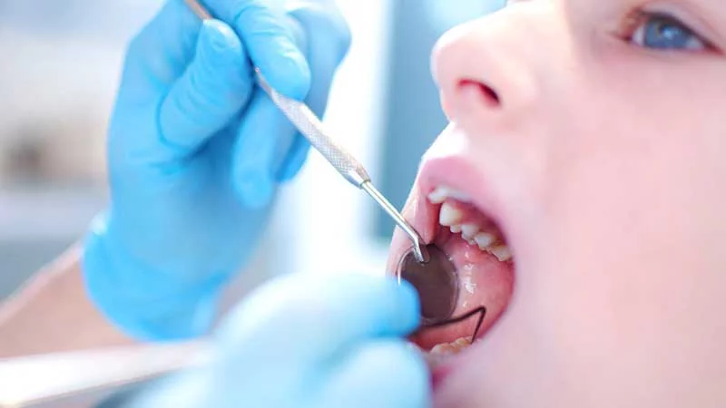 How To Get Rid of Cavity?