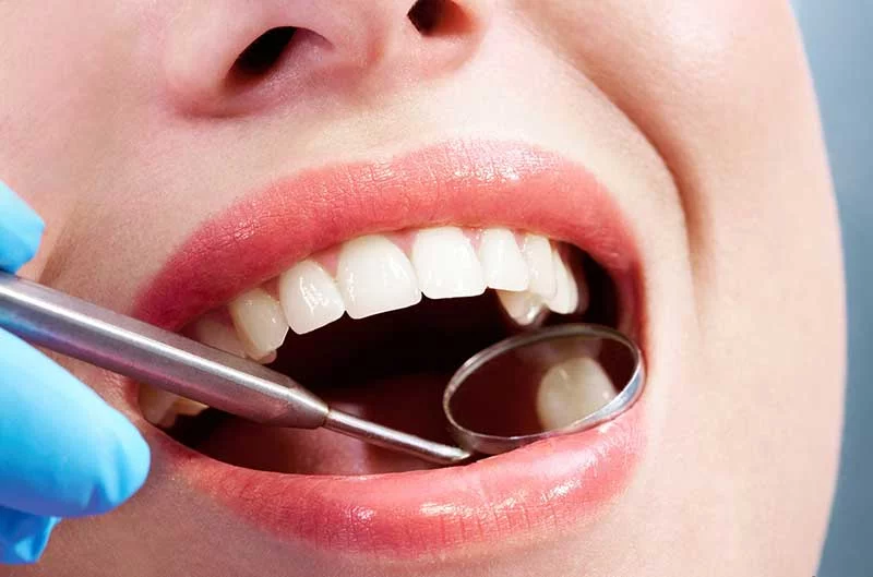 Symptoms Of Tooth Cavity