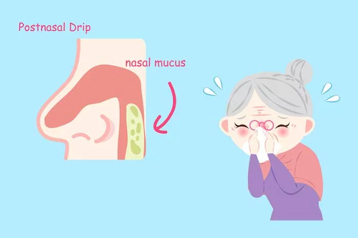 What causes post nasal drip
