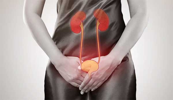 UTI or STD: Difference, Sings, Causes, Test, Precautions