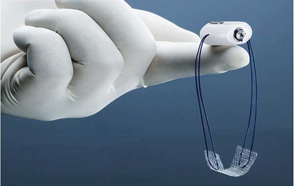 Bladder Mesh Surgery Recovery Time Bladder Mesh Surgery Recovery Time
