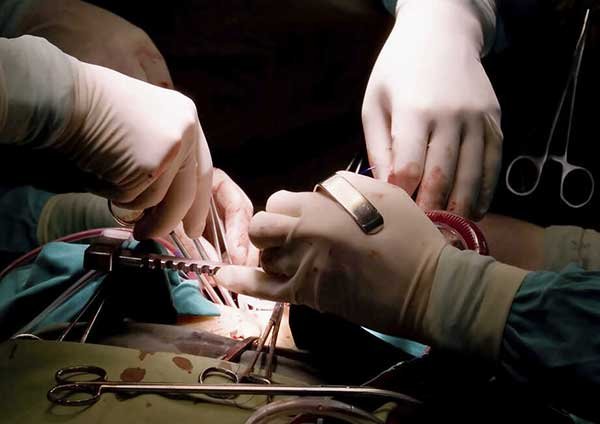 Complications During or Shortly After Surgery Complications During or Shortly After Surgery