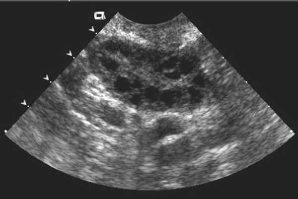 Follicle study ultrasound images Follicle study ultrasound images