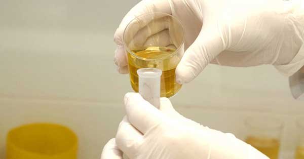 Frequent urination Std or frequent urge to urinate std: