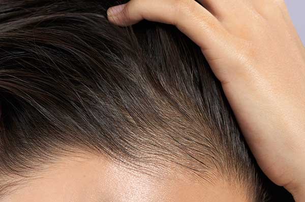 How to Make Baby Hair Grow on Adults - The 5 Tips