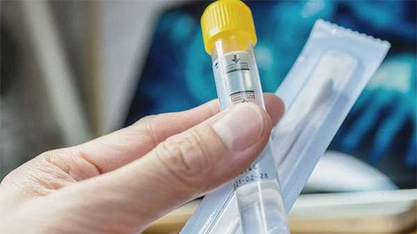 If you have chlamydia will you test positive for a uti?