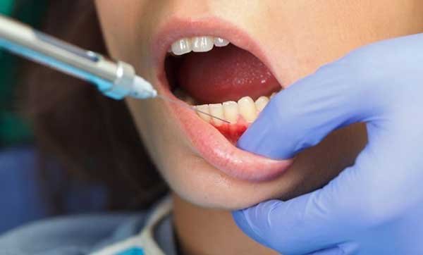 Novocaine & Lidocaine During Pregnancy Novocaine & Lidocaine During Pregnancy