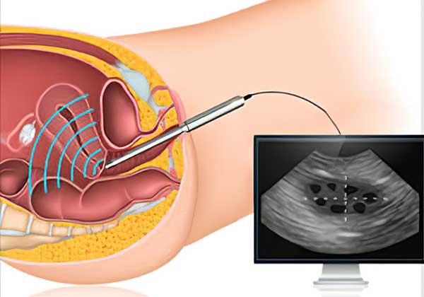 On which day follicular study should be done On which day follicular study should be done
