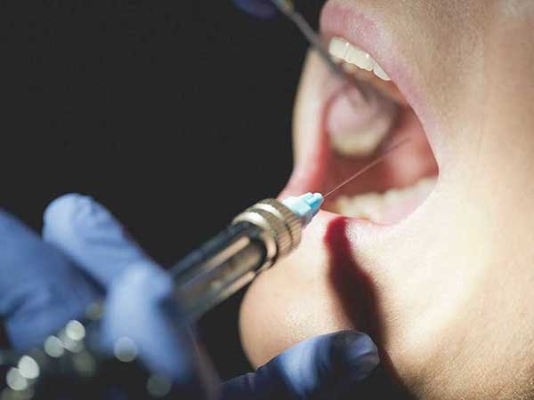 Pregnancy Gingivitis Pregnancy Gingivitis