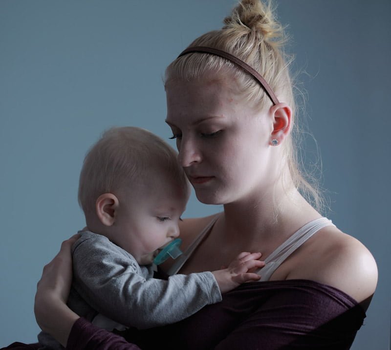 Stinging pain in breast breastfeeding