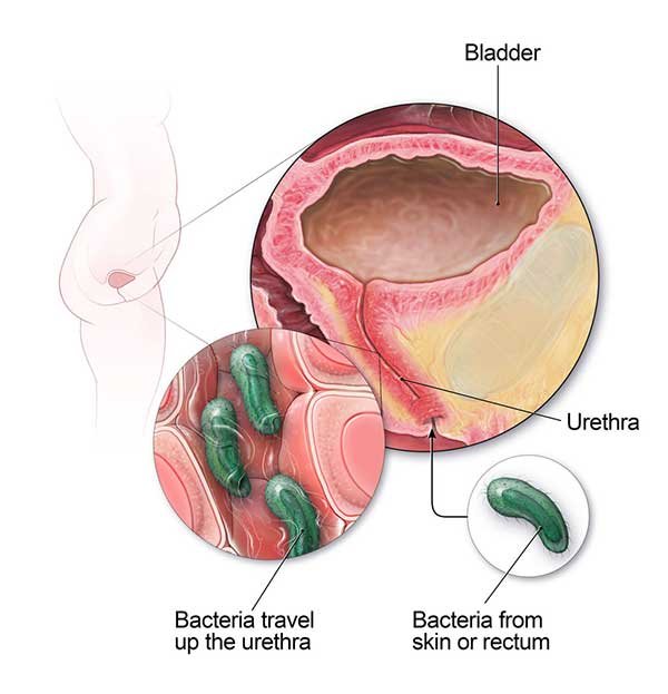 Where can I get tested and treated for an STD or UTI?